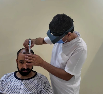HAIR TRANSPLANT PAGE IMAGE