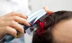 Low-Level Laser Therapy