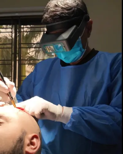 Fut hair transplant
