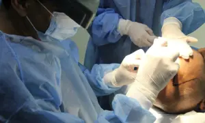 transplant for men and women