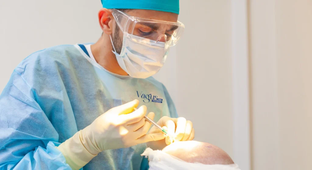 Hair Restoration Maintenance After FUE