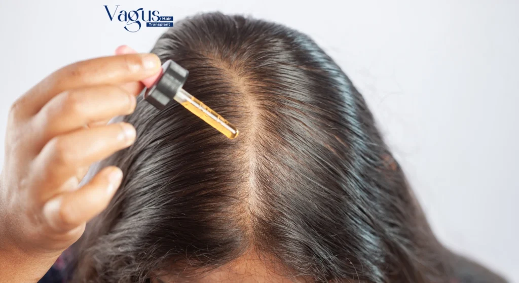 Does Minoxidil Work for Women