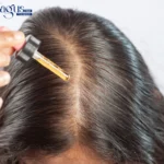 Does Minoxidil Work for Women