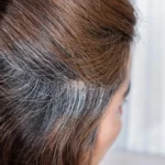 Can Dying Hair Cause Thinning The Truth About Hair Dye and Hair Health
