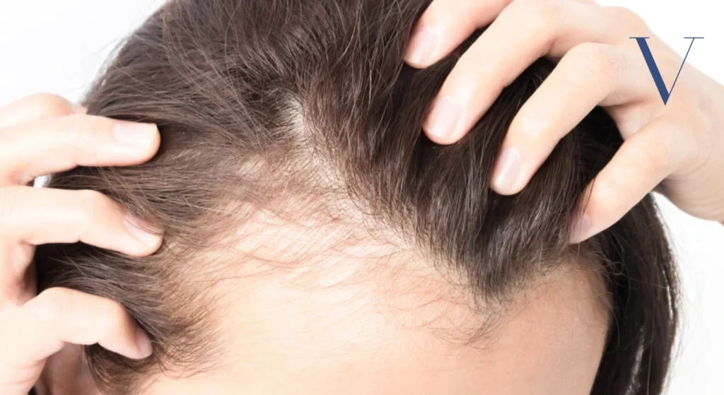Can a Dermatologist Help with Thinning Hair Effective Solutions