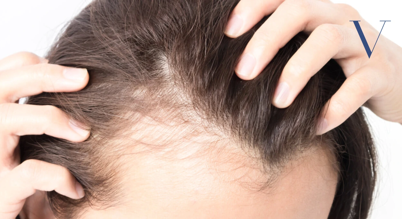 Can a Dermatologist Help with Thinning Hair Effective Solutions