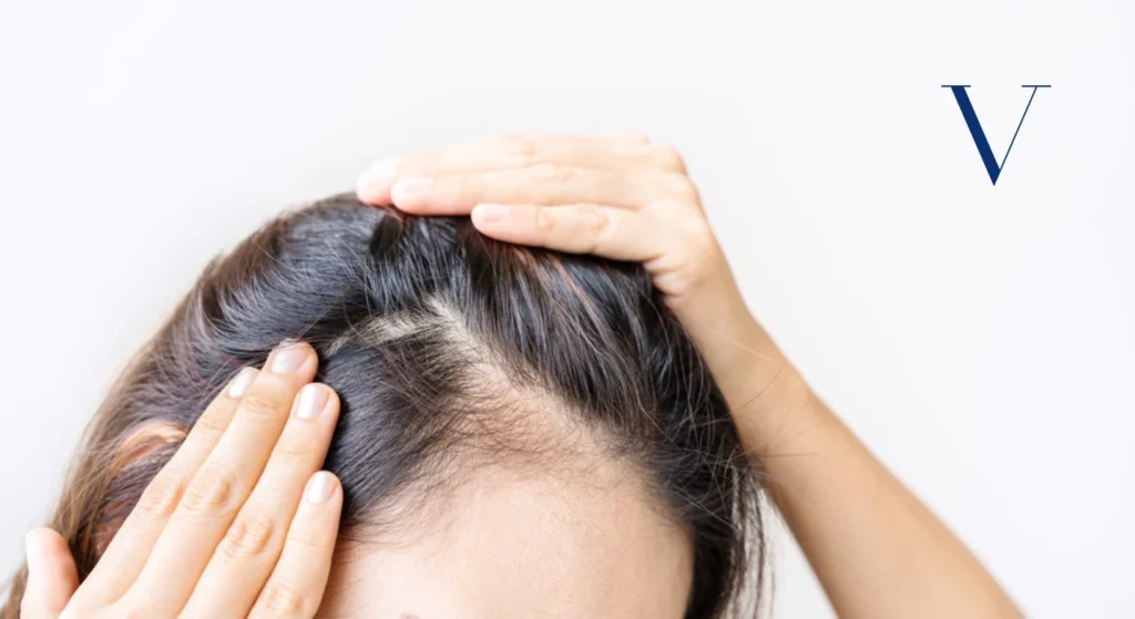 How to Tell If Your Hair Is Thinning 10 Early Signs