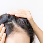 How to Tell If Your Hair Is Thinning 10 Early Signs