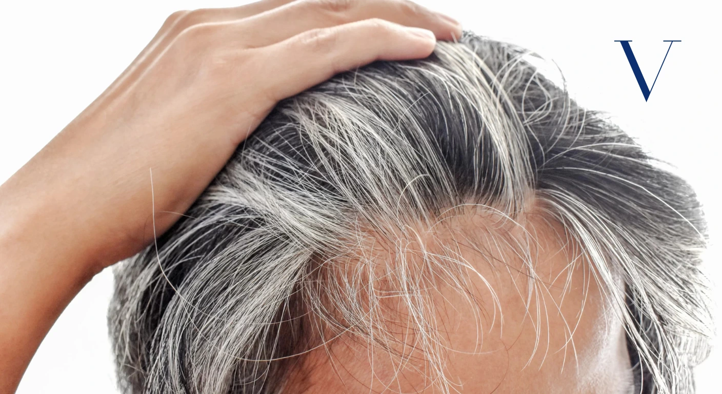 Why Does Hair Turn Grey Causes, Premature Greying