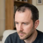 Is Stage 3 Hair Loss Reversible